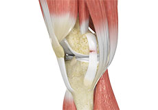 Ligament Injuries