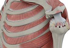 Rotator Cuff Repair